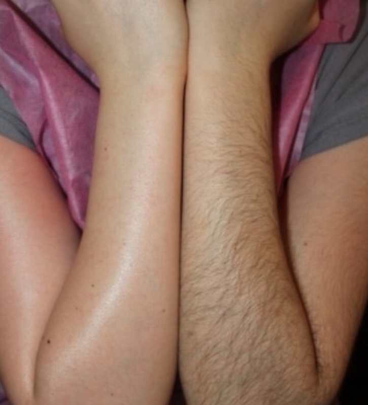 Шугаринг мужской и женский, восковая депиляция  - фотография